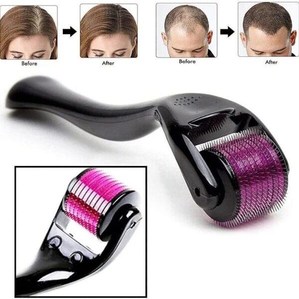 Derma Roller Pour La Croissance Des Cheveux 0,5 Mm Avec Aiguilles En Titane – Active Les Follicules Pileux Pour La Perte et L'épaisseur Des Cheveux – Réduit Les Cicatrices D'acné